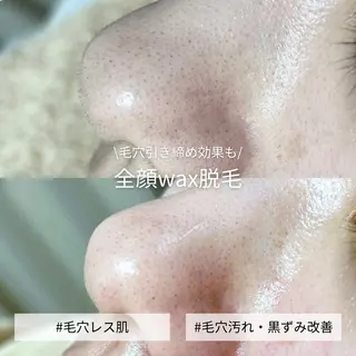 EST BEAUTY所属・顔ワックス脱毛/ ハーブピーリングのエステ・リラクイメージ