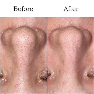 シミ・毛穴専門店 gracia 宇土店所属・シミ・毛穴専門店 /gracia 安藤のエステ・リラクイメージ