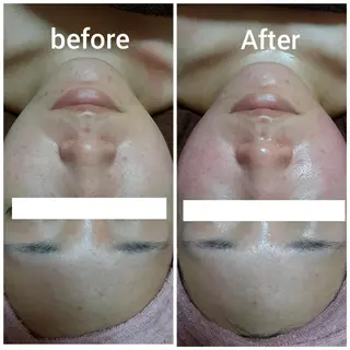 メンズ eyelash and more beauty Pilina所属・Pilina/リラク /痩身/脱毛のエステ・リラクイメージ