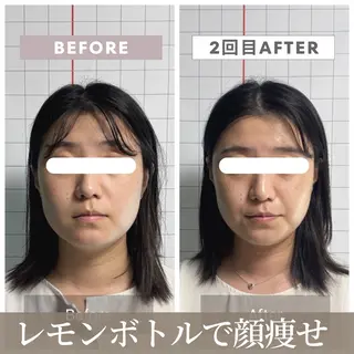 小顔矯正専門店 【RED】池田のエステ・リラクイメージ