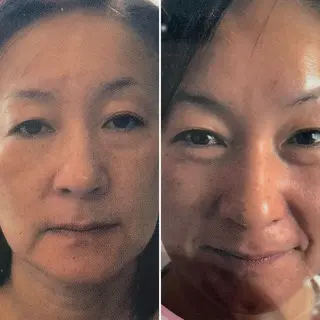 痛くないシミ取り 【荻窪】石橋のヘアスタイル