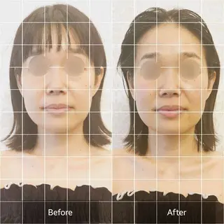 小顔・美肌ケア専門 Diva北浜のエステ・リラクイメージ