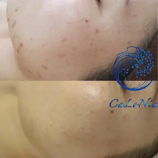 肌質改善・艶髪サロン CaLoNiaのエステ・リラクイメージ