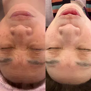 ラ・デエース✨ 肌質改善　中里のエステ・リラクイメージ