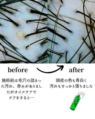 BARBER LIGHT所属・一切ハサミは持たず 髪質改善のみ🌱古川のその他イメージ