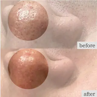 DahliaBeauty ダリアビューティー所属・Dahlia痩身脱毛 フェイシャル 中村のエステ・リラクイメージ