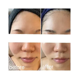 アロマ•ピーリング SalonYokoのその他イメージ