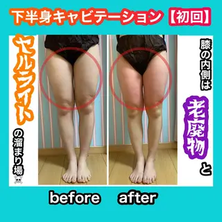 痩身/脱毛/ネイル HARUKAのエステ・リラクイメージ