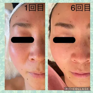 Serenity salonのエステ・リラクイメージ