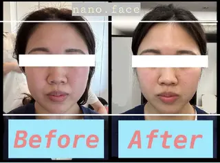 nano.face名古屋駅前店所属・nano.face 名古屋駅前店のエステ・リラクイメージ