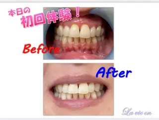 セルフホワイトニングサロン　ラヴィアン所属・ホワイトニングサロン La vie enのその他イメージ