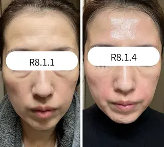 小顔/たるみ/黒ずみ除去専門サロン/SONA 大和西大寺店所属・【小顔専門看護師 サロンSONA】のエステ・リラクイメージ