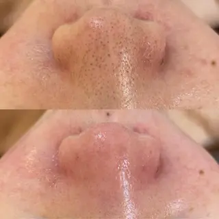 BELCIA福岡店　récolte de BELCIA（レコルトデベルシア）所属・BELCIA福岡店 レコルトデベルシアのエステ・リラクイメージ