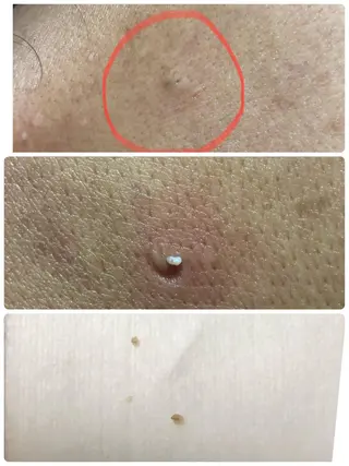 private salon  Dea_maris シュガーリング＆パーソナルボディケア所属・シミ改善・韓国肌管理 ボディメイク痩身のその他イメージ