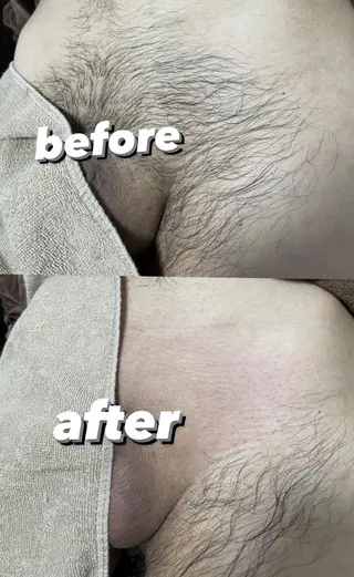 メンズ キッズ Epina 千葉店 【エピナ】のエステ・リラクイメージ