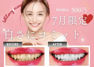 セルフホワイトニング エクシア沖縄宮里店のその他イメージ