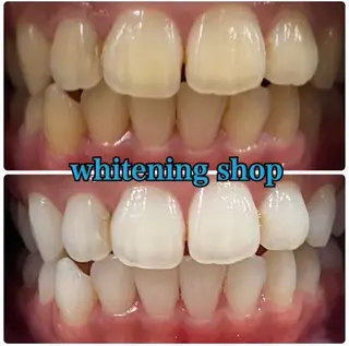 ホワイトニング ショップ吉祥寺店のエステ・リラクイメージ