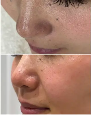 MY FAIR LADY所属・毛穴に特化したサロン MYFAIRLADYのエステ・リラクイメージ