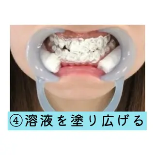 ホワイトニングサロン ネージュ(女性専用)のその他イメージ