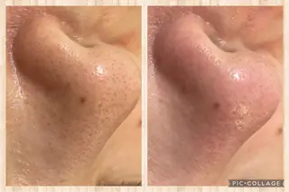 杉原 里奈のエステ・リラクイメージ