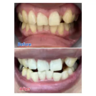 MBEAUTYSALON 千葉店・京成大久保所属・Melty 輝のその他イメージ