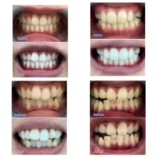 M渋谷店所属・M渋谷 ホワイトニングのエステ・リラクイメージ