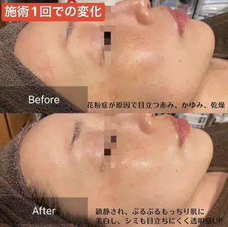 ビューティースリム reborn吉祥寺店のエステ・リラクイメージ