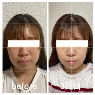 小顔サロン AMYONのエステ・リラクイメージ