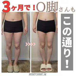 HISTOIRE.M イストアールエム所属・ダイエット/体質改善 /筋膜リリース専門店のエステ・リラクイメージ