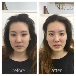 小顔&ダイエットジム エステ担当REIKOのその他イメージ