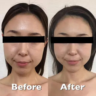 桜Biscuit所属・小顔筋膜矯正サロン 桜Biscuitのエステ・リラクイメージ