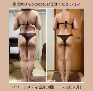 biloop所属・《痩身×疲労改善》 BILOOPのエステ・リラクイメージ