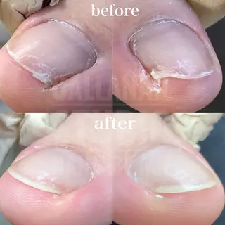 ネイル mie ミイのネイルデザイン