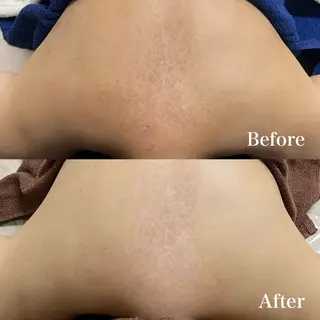 𝐌𝐚𝐜𝐡𝐞 𝐛𝐲 𝐌𝐚𝐲𝐮所属・ハーブピーリング🌿 𝑴𝒂𝒚𝒖のエステ・リラクイメージ