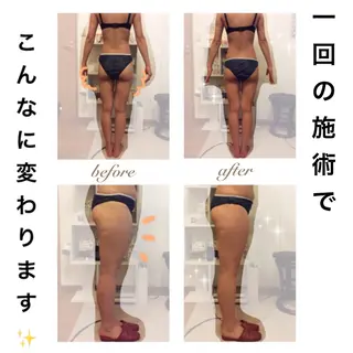 ダイエット・美肌ケア fleurのエステ・リラクイメージ