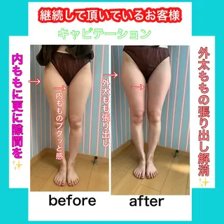 痩身/脱毛/ネイル HARUKAのエステ・リラクイメージ