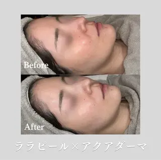 看護師が施術する美容 🍒ナスサロ/わだのエステ・リラクイメージ