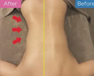 biloop所属・《本気痩せ×疲労改善 》  BILOOPのエステ・リラクイメージ