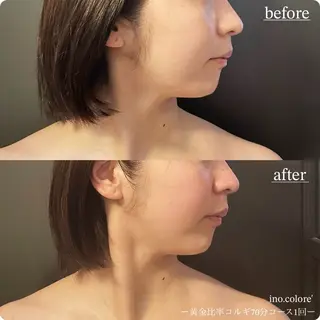 エステサロンino.colore'所属・小顔サロン ino.coloreのエステ・リラクイメージ