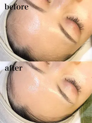 マツエク・マツパ リュクス 西新店のエステ・リラクイメージ