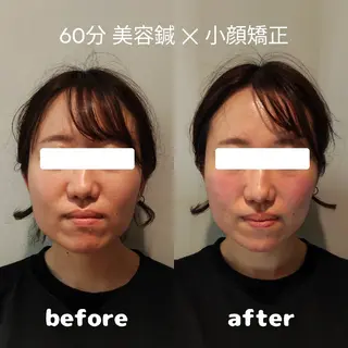 美容鍼灸サロンAria所属・美容鍼サロンAria 杉元みつるのエステ・リラクイメージ