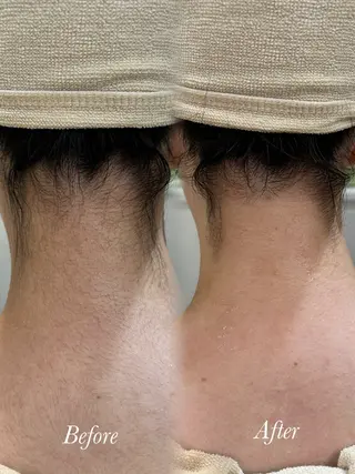 🫧美しい素肌へ🫧 今成柚乃のその他イメージ