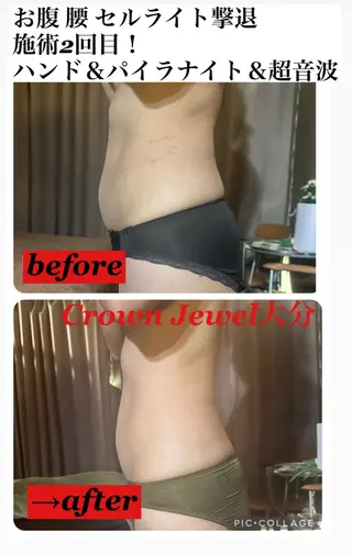 Crown  Jewel所属・CrownJewel クラウン ジュエルのエステ・リラクイメージ