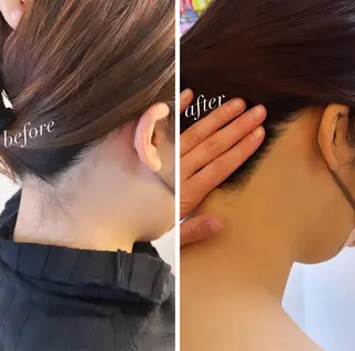 うなじ脱毛/美肌脱毛 LABELのエステ・リラクイメージ