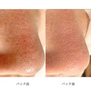 肌質改善🌿 彩也乃のエステ・リラクイメージ