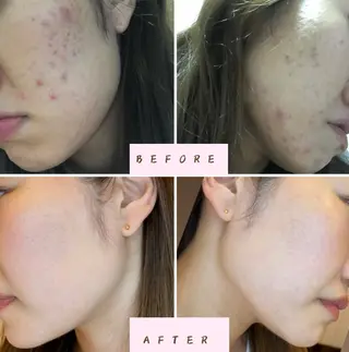 partir銀座店所属・横山 知子のエステ・リラクイメージ