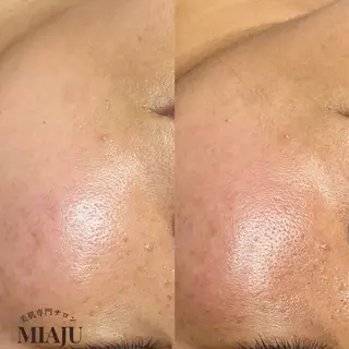 美肌専門サロン MIAJUのエステ・リラクイメージ