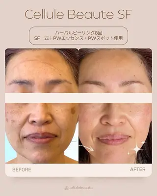 スキンケアサロン　デディア所属・米谷🎀 デディア恵比寿🪞✨のエステ・リラクイメージ