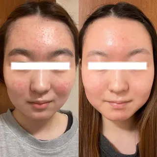 脱毛・肌質改善サロン Linoのエステ・リラクイメージ