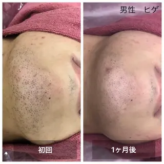 美容＆脱毛サロン 金沢文庫のエステ・リラクイメージ